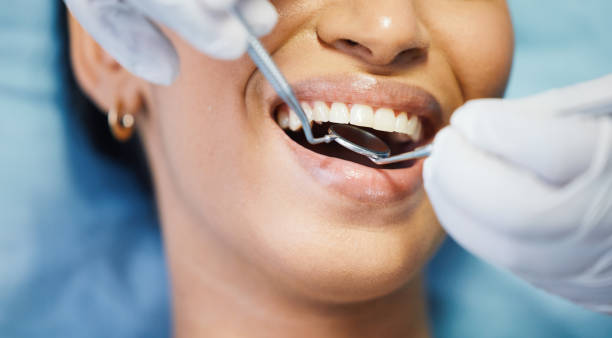 Best Emergency Denture Repair in Rialto, CA